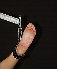 Bound Feet Punished